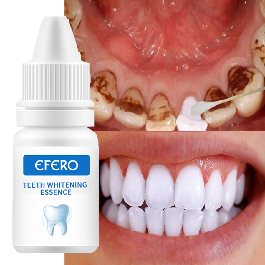 Teeth Whitening Essence Cleaning Serum® – Best Gadget Store